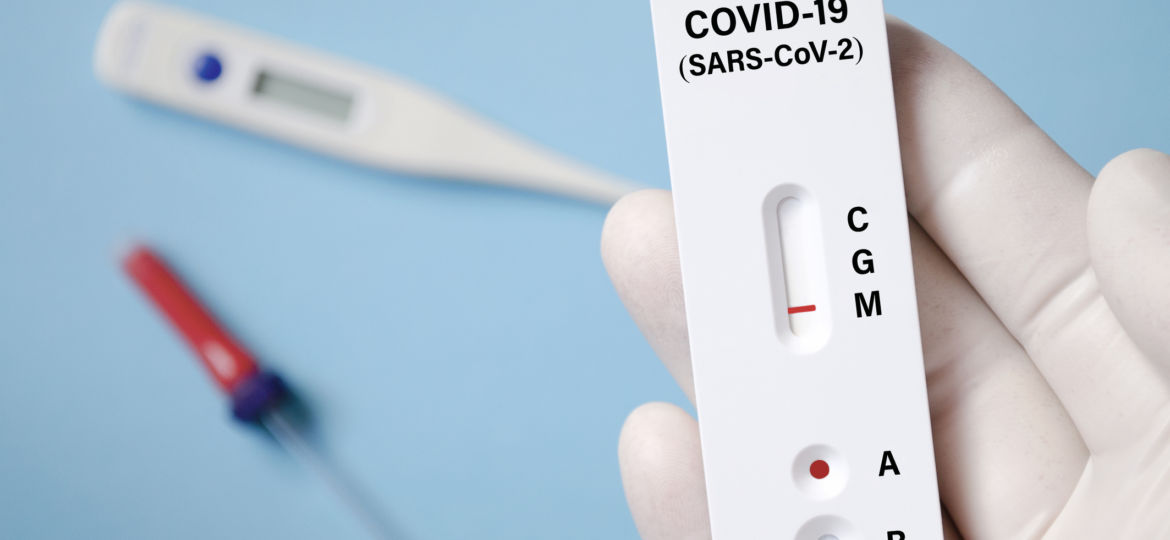 Positive test result by using rapid test for COVID-19, quick fast antibody point of care testing. Lab performing rapid diagnostic test for antibodies to detect presence of antigens COVID-19 disease.
